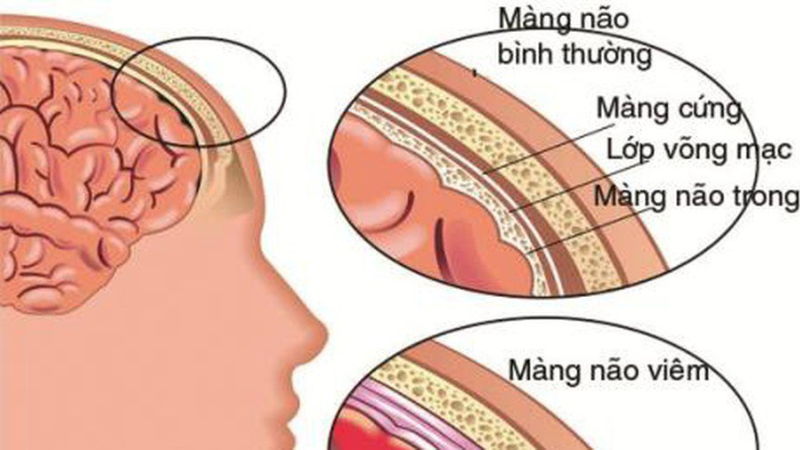 thời gian ủ bệnh dại ở người